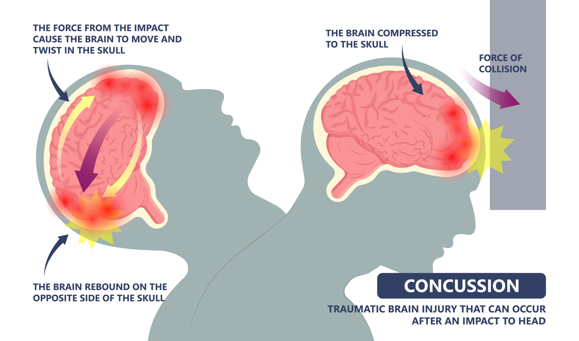 What happens medically when you hit the face? Understanding the immediate physical risks and potential dangers involved.